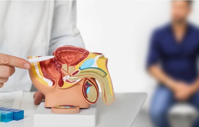 noticia Câncer da próstata: diagnóstico precoce e avanço do tratamento aumentam chances de cura e qualidade de vida