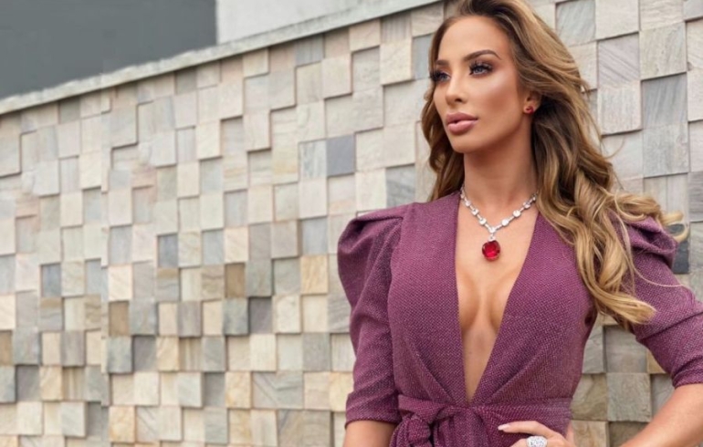 noticia Modelo Michelle Heiden realiza Harmonização para participar de concurso de beleza