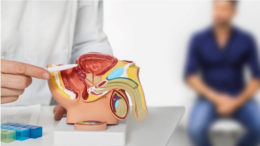 noticia Câncer da próstata: diagnóstico precoce e avanço do tratamento aumentam chances de cura e qualidade de vida